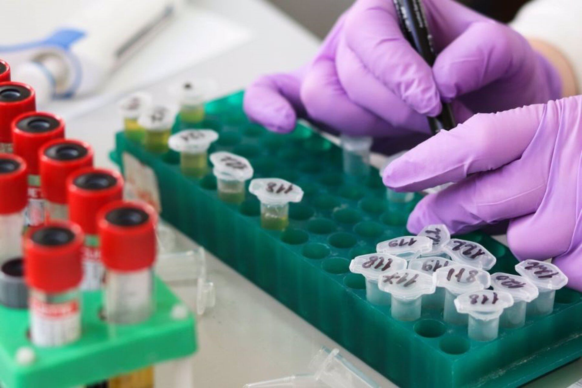 Desregulación: Nueva Política Gubernamental Impulsa Importaciones Científicas