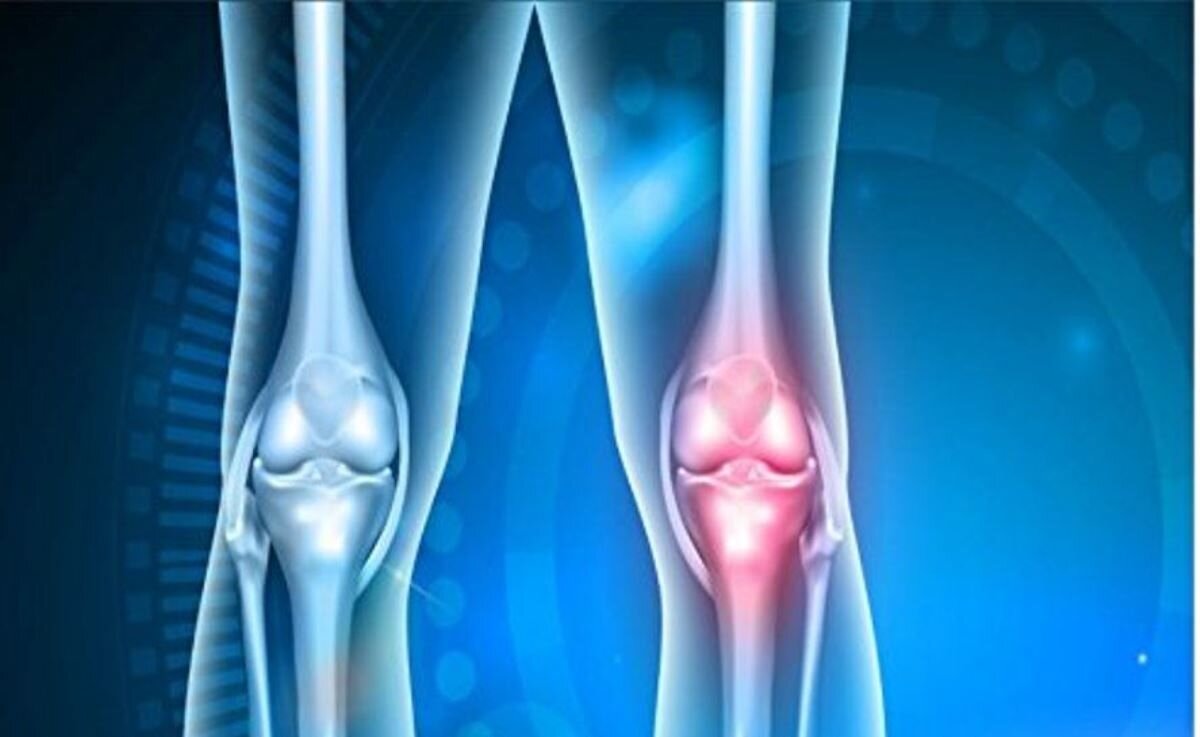 Articulaciones sanas: la importancia del colágeno en su mantenimiento