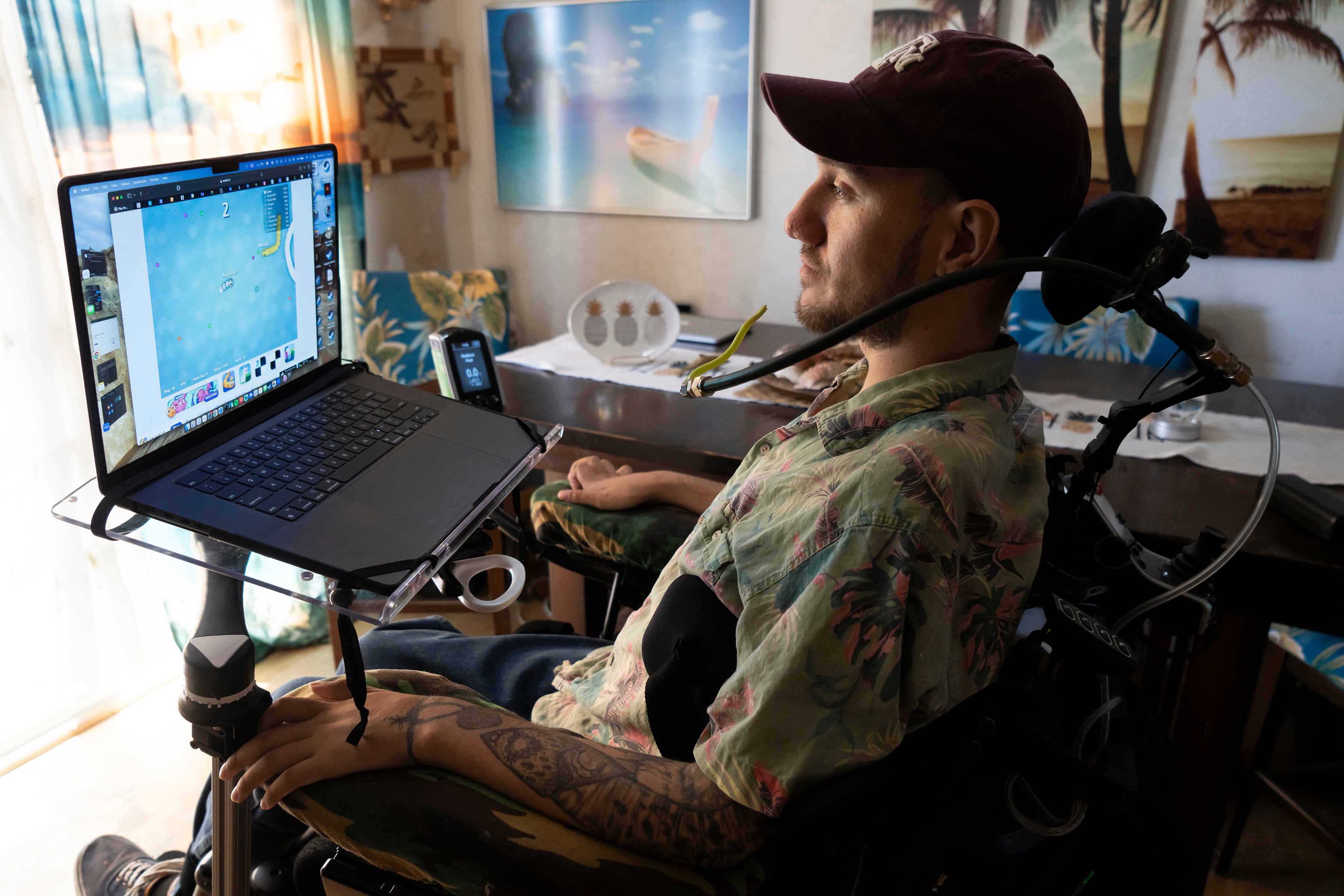 image preview(placeholder)